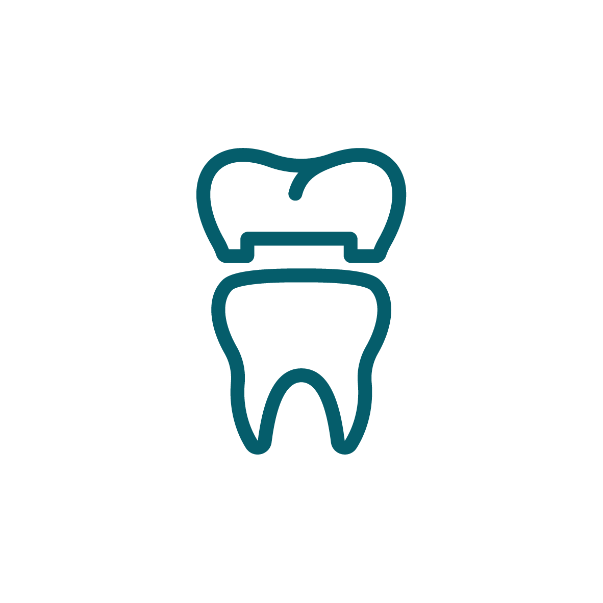 Aligners - Orthodontics